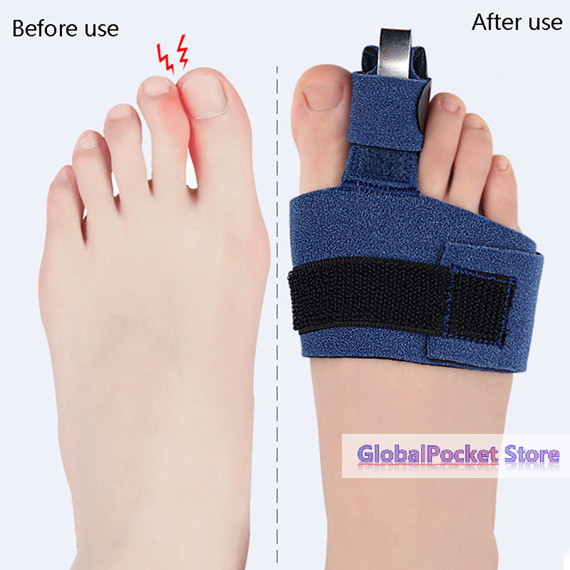 1Pcs Toe Corrector Toe Fractur - Ankle Brace Sock avis et prix