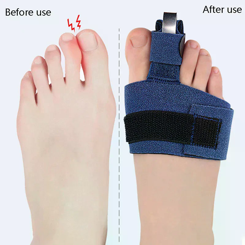 1Pcs Toe Corrector Toe Fractur - Ankle Brace Sock avis et prix